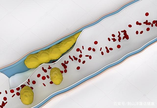 抬头纹多是运气不好吗？抬头纹不但显老，而且与健康有关，一言以蔽之。 