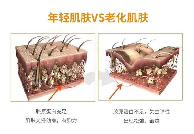 干纹疯长怎么办？天天喝碗汤，喂饱干渴肌肤，告别暗沉松弛。 